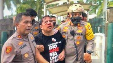 Polisi Amankan Pelaku Pemukulan Ade Armando