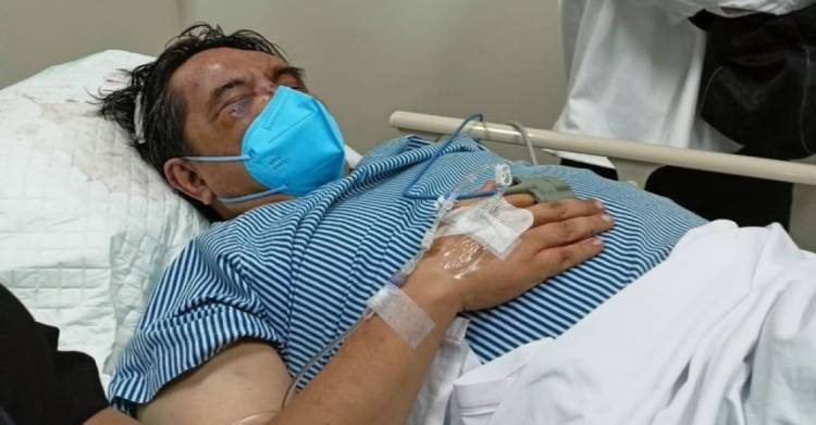 Ade Armando Alami Pendarahan Otak dan Gangguan Kandung Kemih