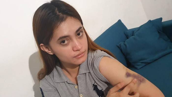Oknum Polwan Polda Riau Aniaya Wanita Muda Dijatuhi Sanksi Demosi